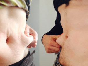 Certains compléments alimentaires dits « minceur » ne sont pas sans danger !