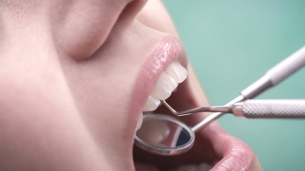 Sant&eacute; bucco dentaire. Prendre soin de ses dents, les bons gestes &agrave; adopter