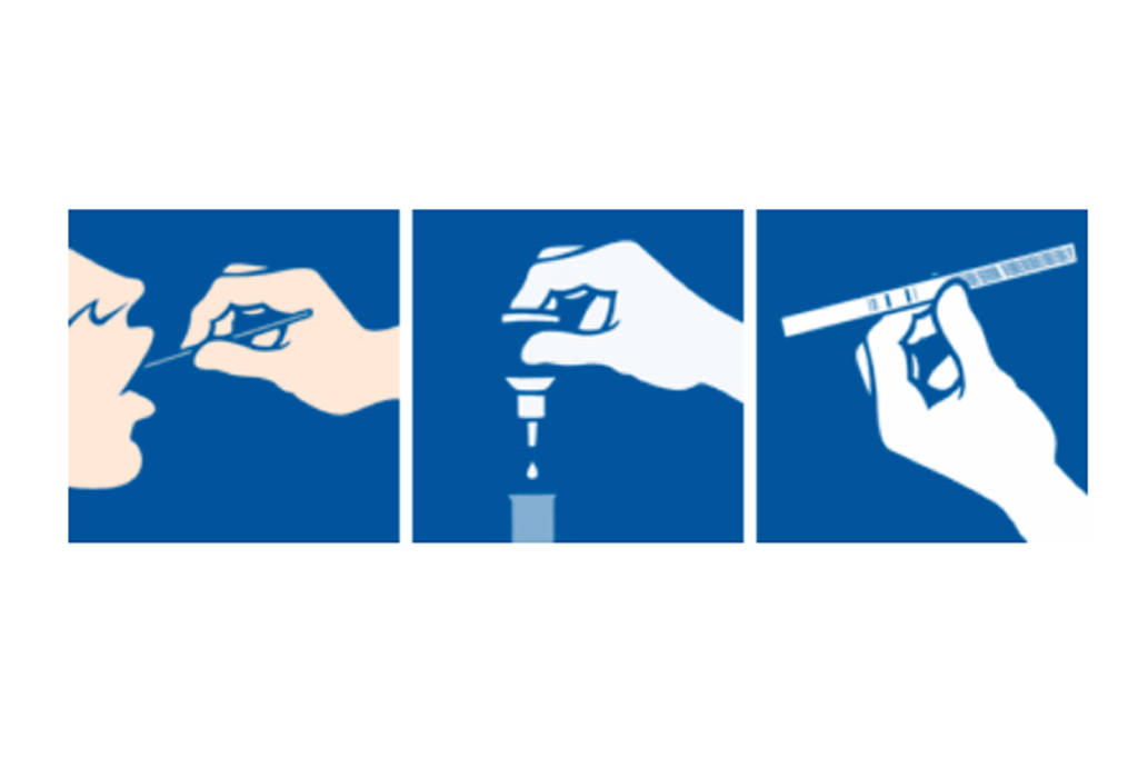 Angine : encore trop de prescriptions d’antibiotiques alors que les TDR existent