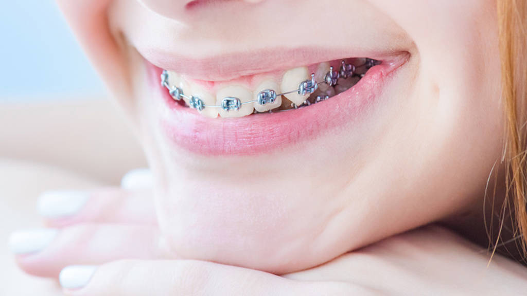 Tarifs de soins en orthodontie