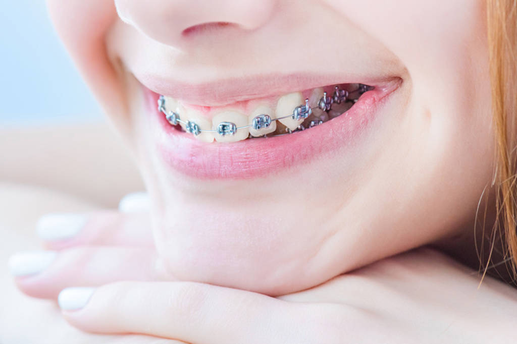 Tarifs de soins en orthodontie
