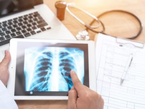 La téléconsultation en questions