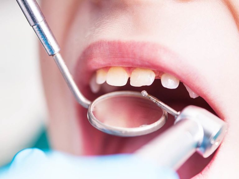 Prix / Tarif Consultation Dentiste - Remboursement des soins dentaires
