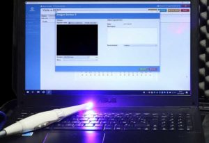 Des consultations dentaires par vidéo pour personnes en situation de handicap mental