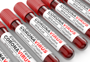 Test sérologique au Covid-19 : ai-je eu le virus ?