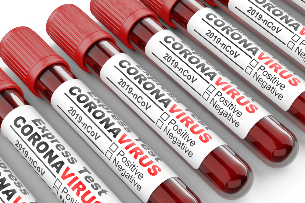 test sérologique au covid 19