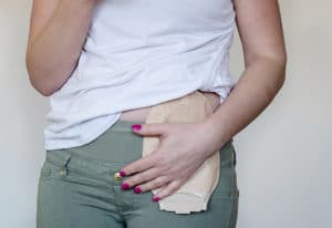 Témoignages : le quotidien de deux personnes stomisées